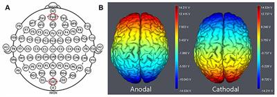 Modulating the Activity of the VMPFC With tDCS Alters the Social Framing Effect